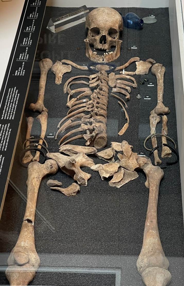 A skeleton in a glass case
Description automatically generated